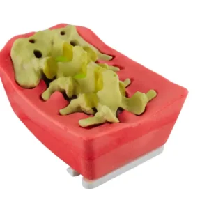 RealSpine Basic - Spondy Posterior L3/S1